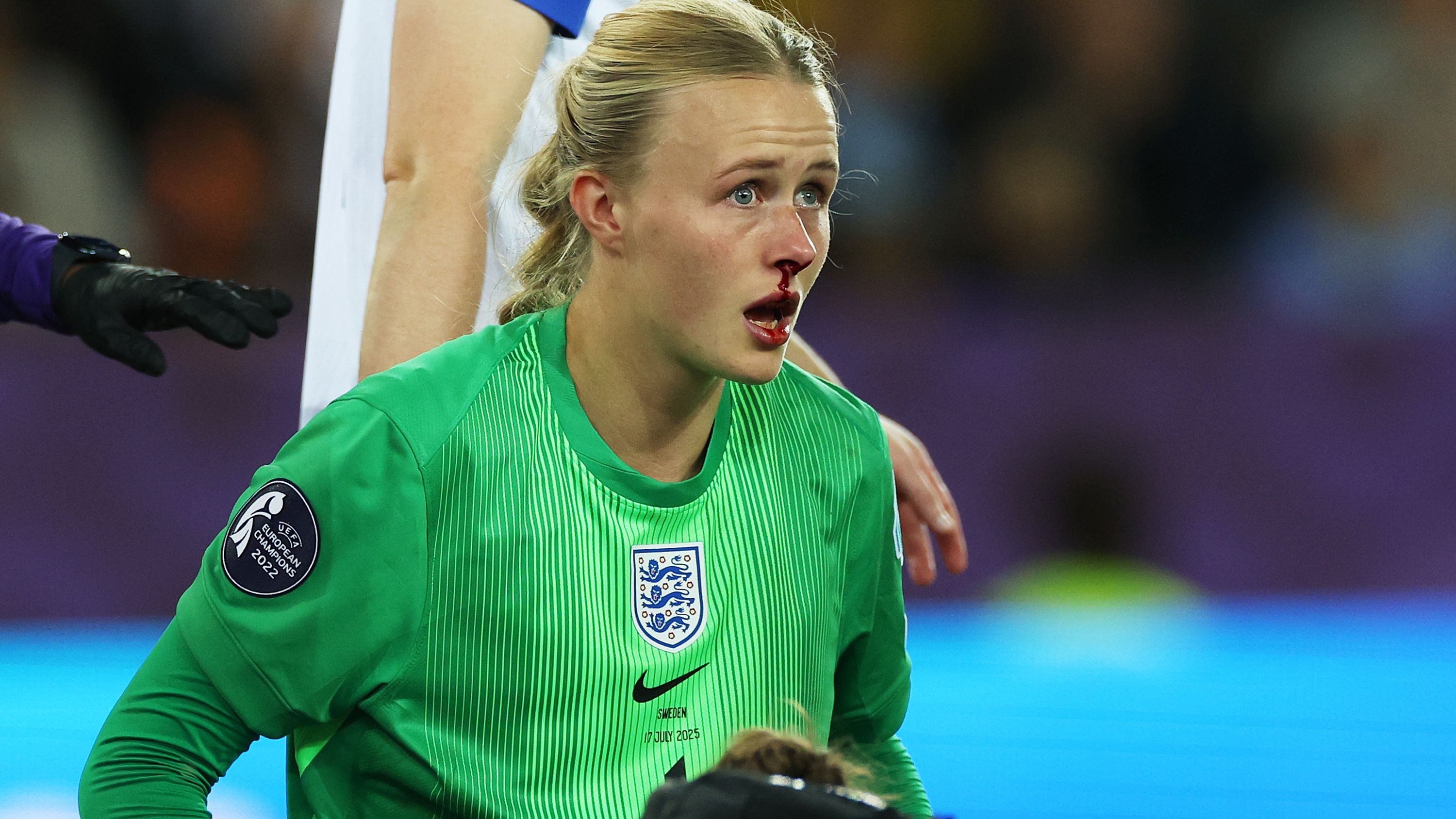 'Better with one nostril!' - Bloodied Hannah Hampton revels in Lionesses penalty shootout glory after stepping into Mary Earps' role for Euro 2025