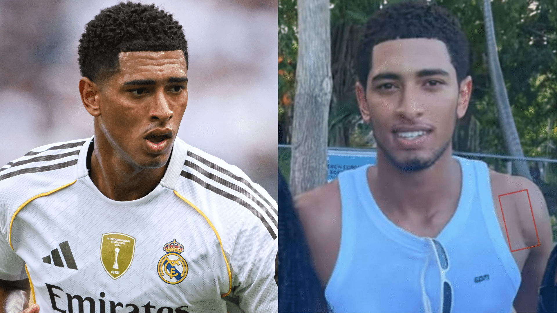 Real Madrid star Jude Bellingham shows off shoulder surgery scar as England international prepares to sit out start of 2025-26 campaign