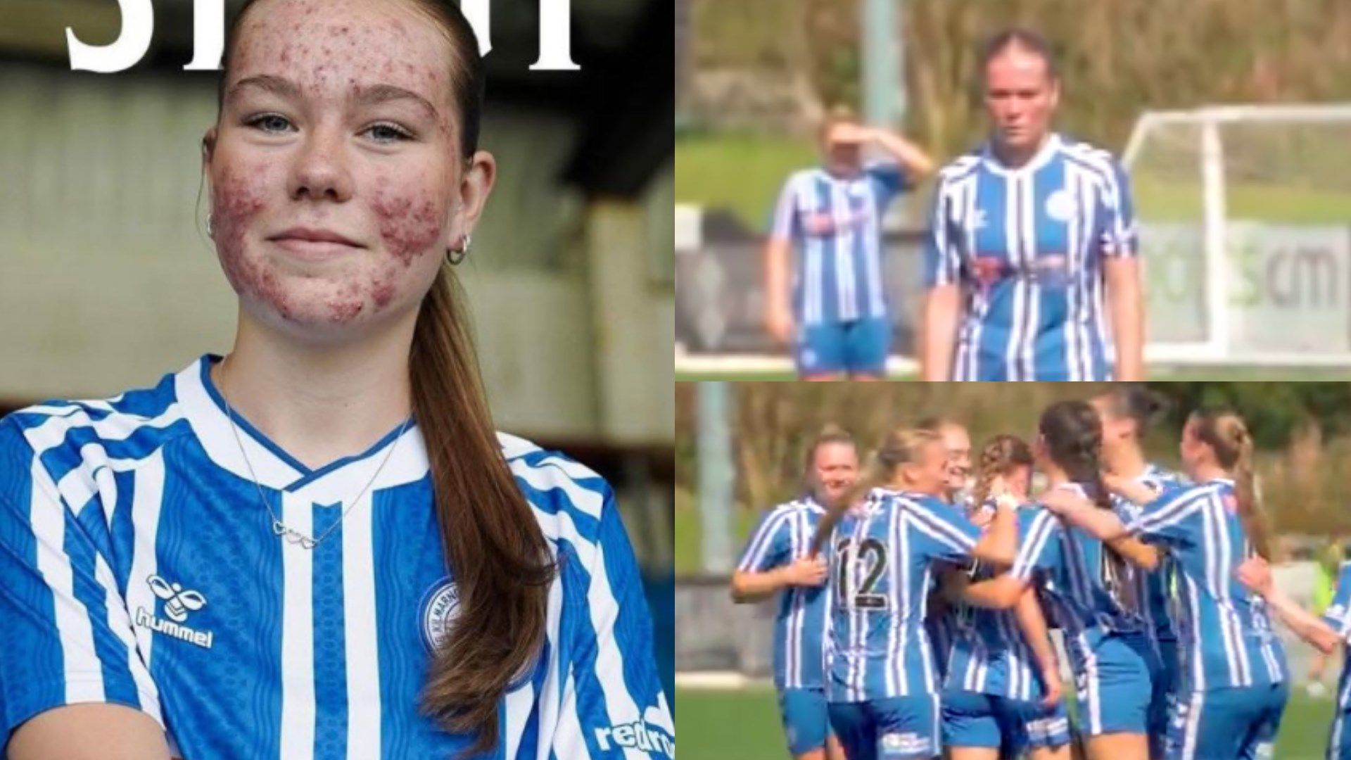 VIDEO: That's how to shut up the haters! Kilmarnock youngster Skye Stout scores <a href=
